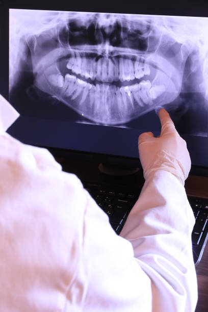 Best Emergency Dental Extractions in Highland Park, MI