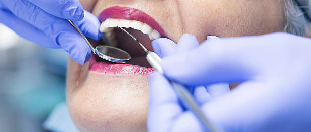 Best Emergency Dentist for Knocked-Out Tooth in Highland Park, MI